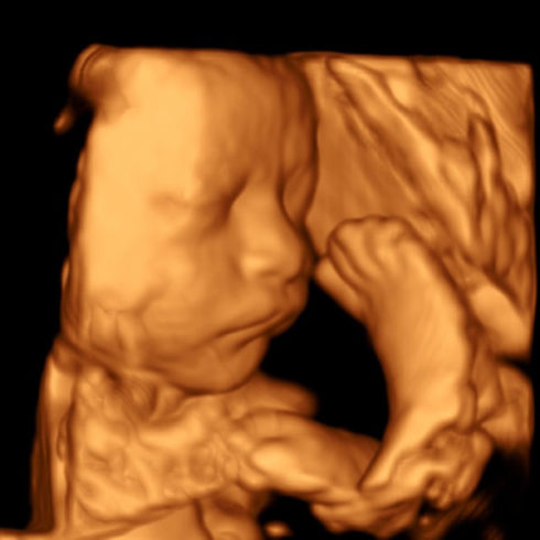Alpinion Italia | Fetal face in 3D mode
